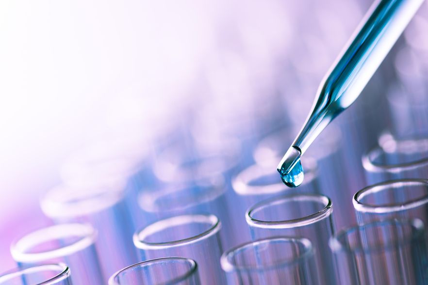 Pipette und Reagenzgl&auml;ser